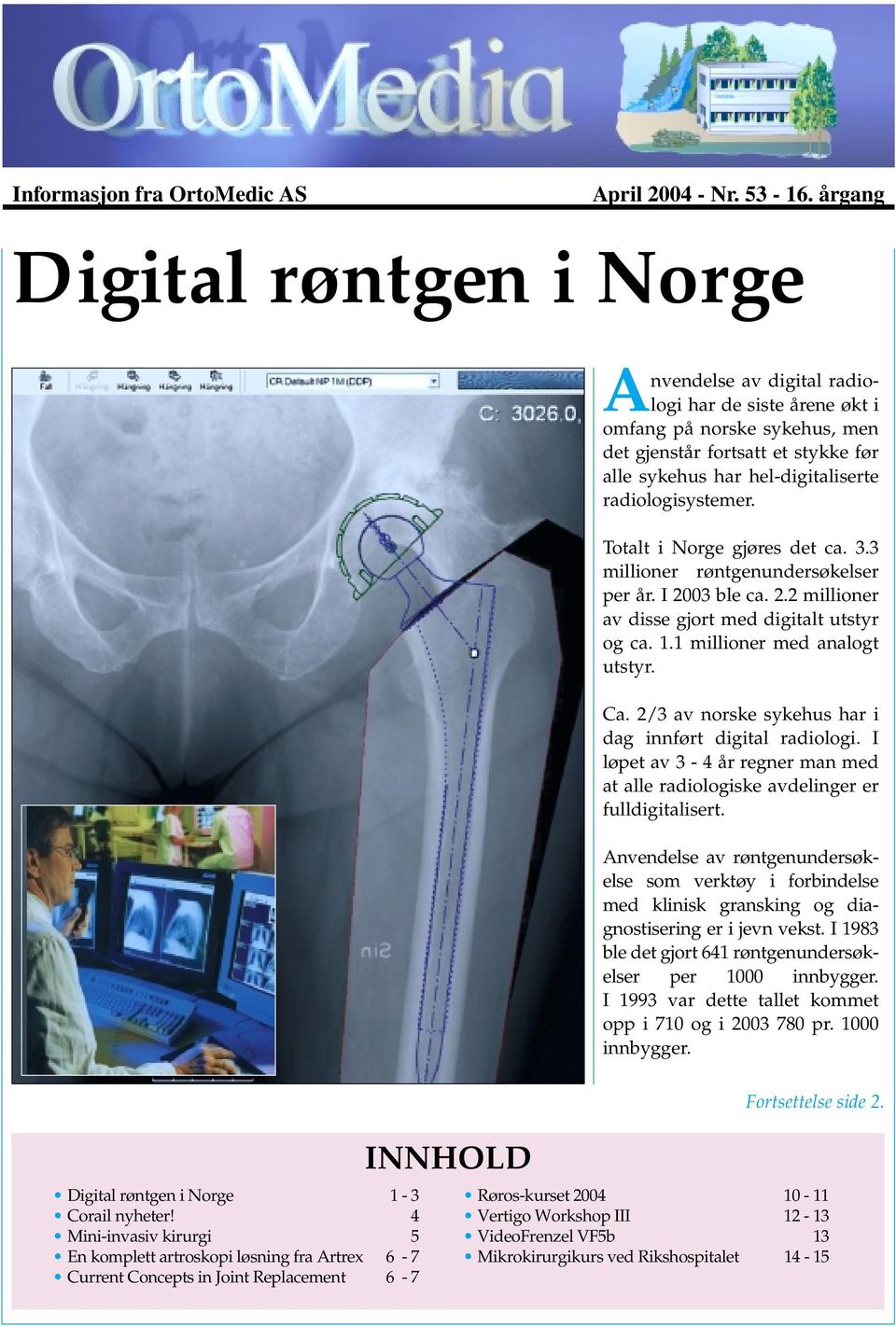 radiologisystemer. Totalt i Norge gjøres det ca. 3.3 millioner røntgenundersøkelser per år. I 2003 ble ca. 2.2 millioner av disse gjort med digitalt utstyr og ca. 1.1 millioner med analogt utstyr. Ca.