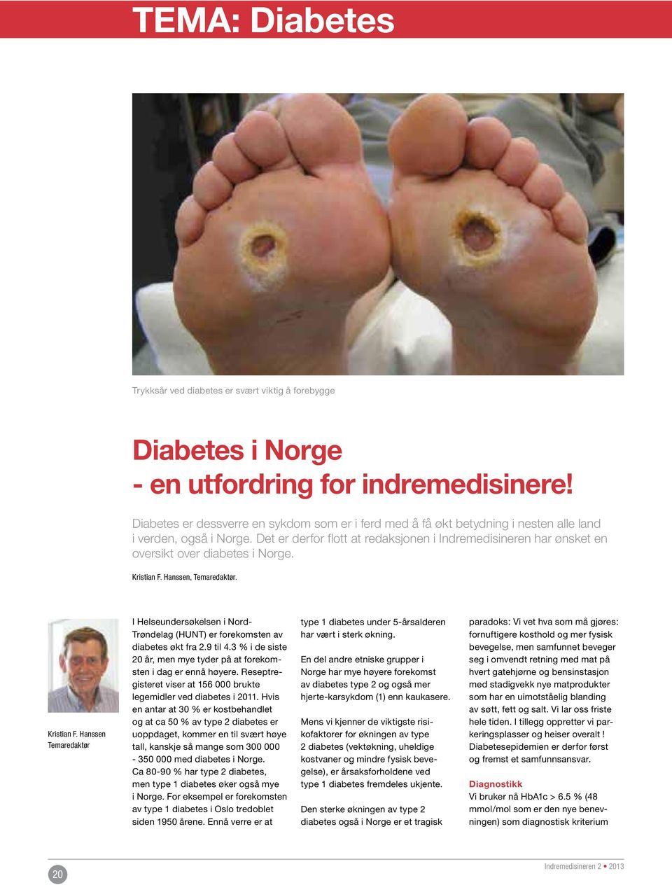 Det er derfor flott at redaksjonen i Indremedisineren har ønsket en oversikt over diabetes i Norge. Kristian F.