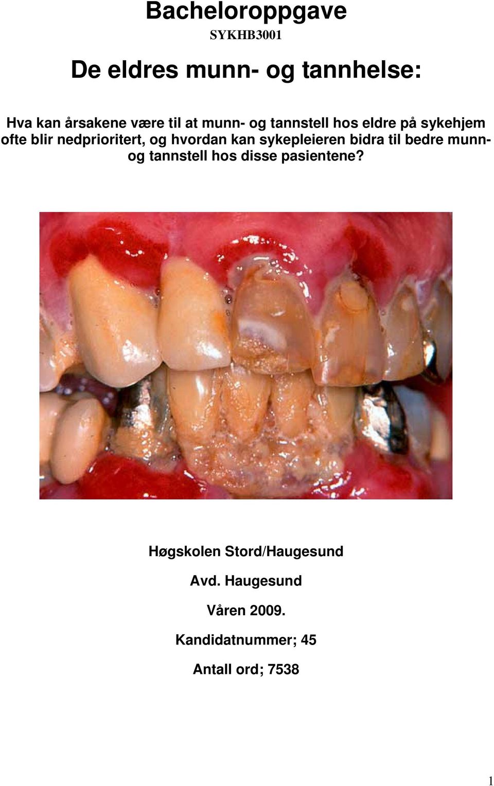 hvordan kan sykepleieren bidra til bedre munnog tannstell hos disse pasientene?