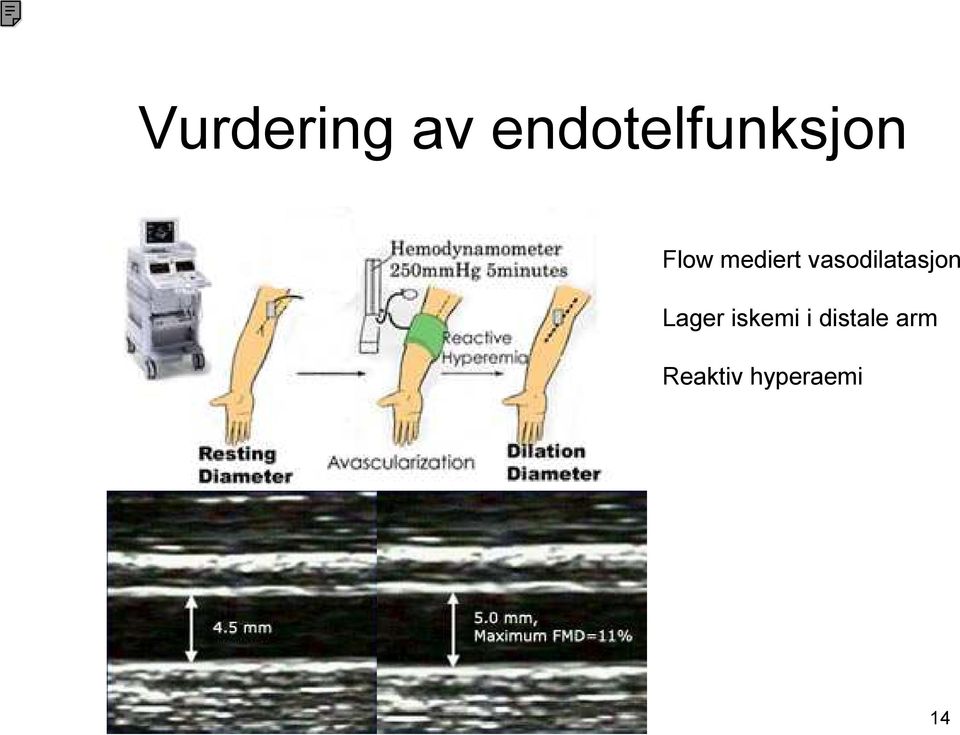 mediert vasodilatasjon