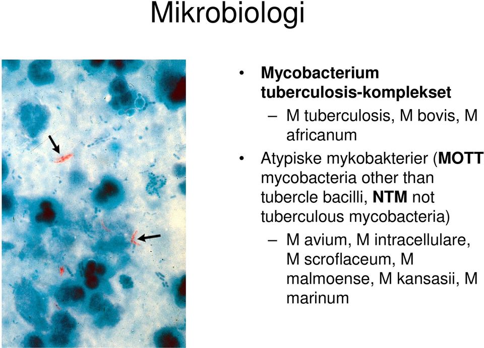 other than tubercle bacilli, NTM not tuberculous mycobacteria) M