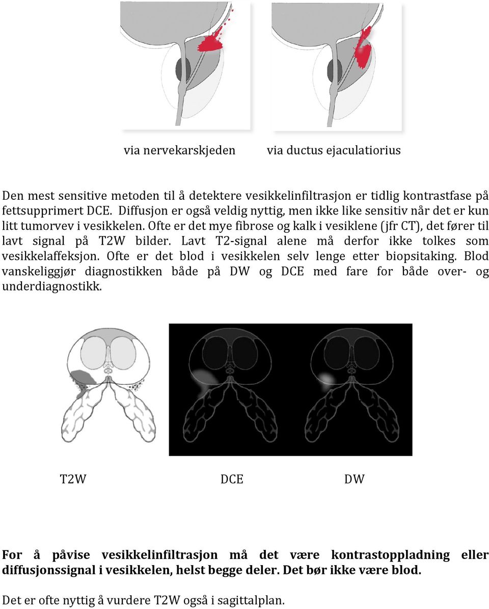 Lavt T2-signal alene må derfor ikke tolkes som vesikkelaffeksjon. Ofte er det blod i vesikkelen selv lenge etter biopsitaking.