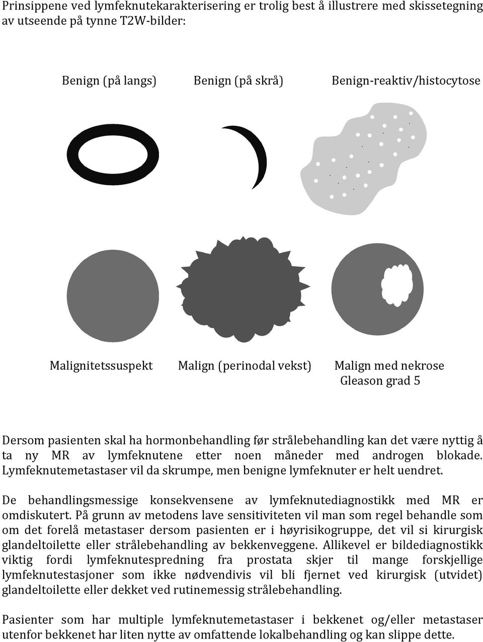 måneder med androgen blokade. Lymfeknutemetastaser vil da skrumpe, men benigne lymfeknuter er helt uendret. De behandlingsmessige konsekvensene av lymfeknutediagnostikk med MR er omdiskutert.