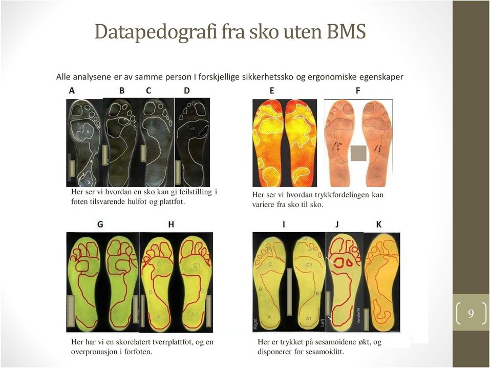 plattfot. Her ser vi hvordan trykkfordelingen kan variere fra sko til sko.