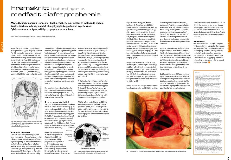 Tekst: Hans Skari, Barnekirurgisk seksjon, Kirurgisk klinikk, Rikshospitalet Typisk for nyfødte med CDH er akutte pusteproblemer og evt. respirasjonssvikt.