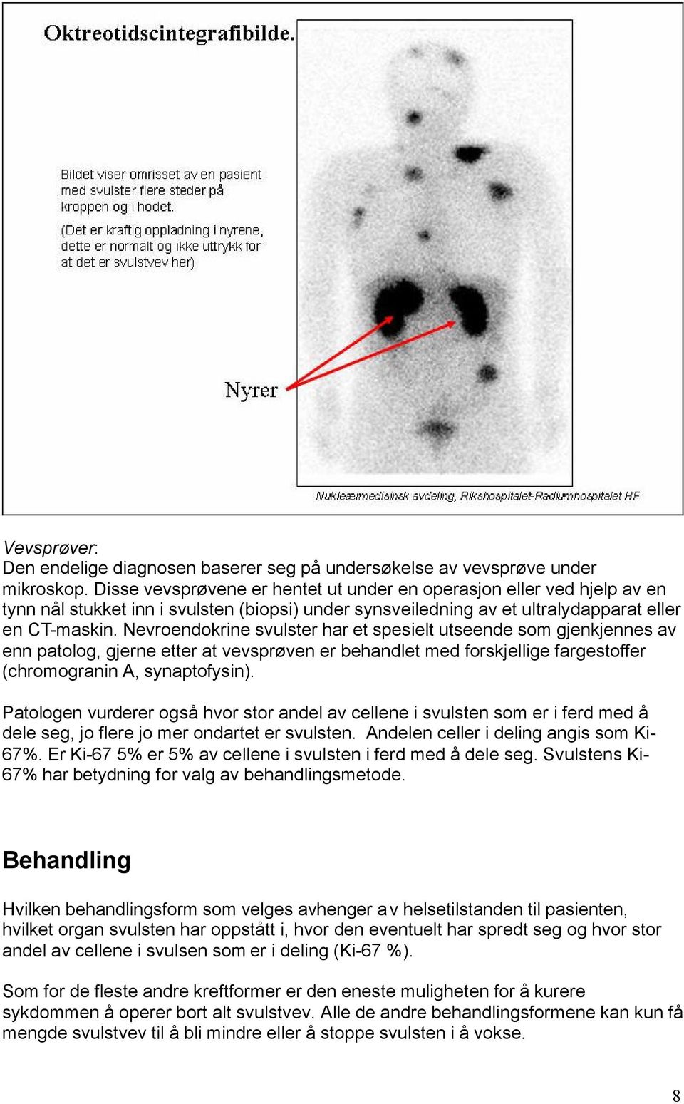 Nevroendokrine svulster har et spesielt utseende som gjenkjennes av enn patolog, gjerne etter at vevsprøven er behandlet med forskjellige fargestoffer (chromogranin A, synaptofysin).