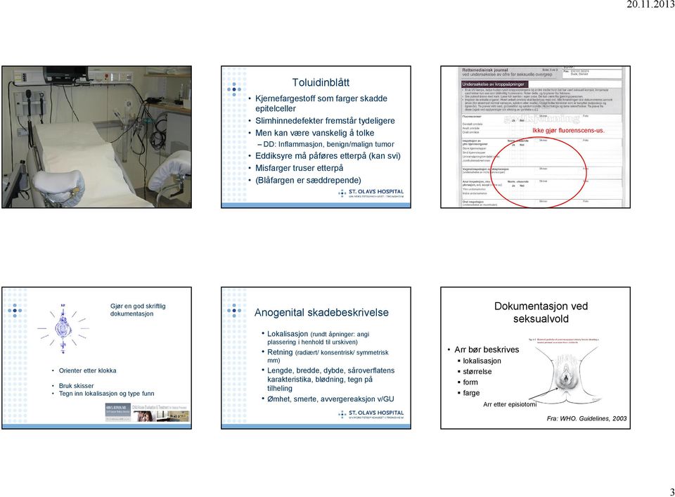 Orienter etter klokka Gjør en god skriftlig dokumentasjon Bruk skisser Tegn inn lokalisasjon og type funn Anogenital skadebeskrivelse Lokalisasjon (rundt åpninger: angi plassering i henhold til