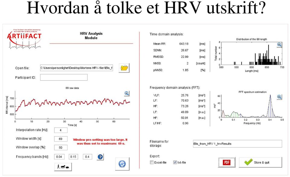 HRV