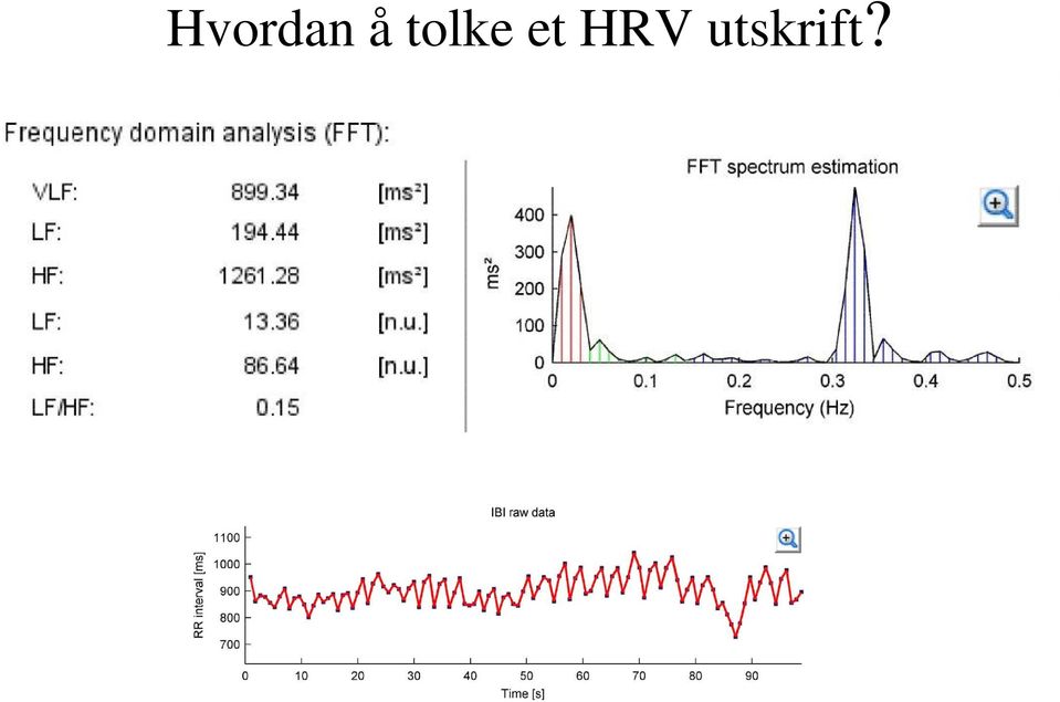 HRV