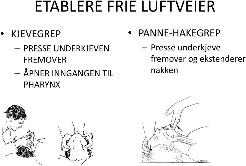 INNGANGEN TIL PHARYNX PANNE-HAKEGREP