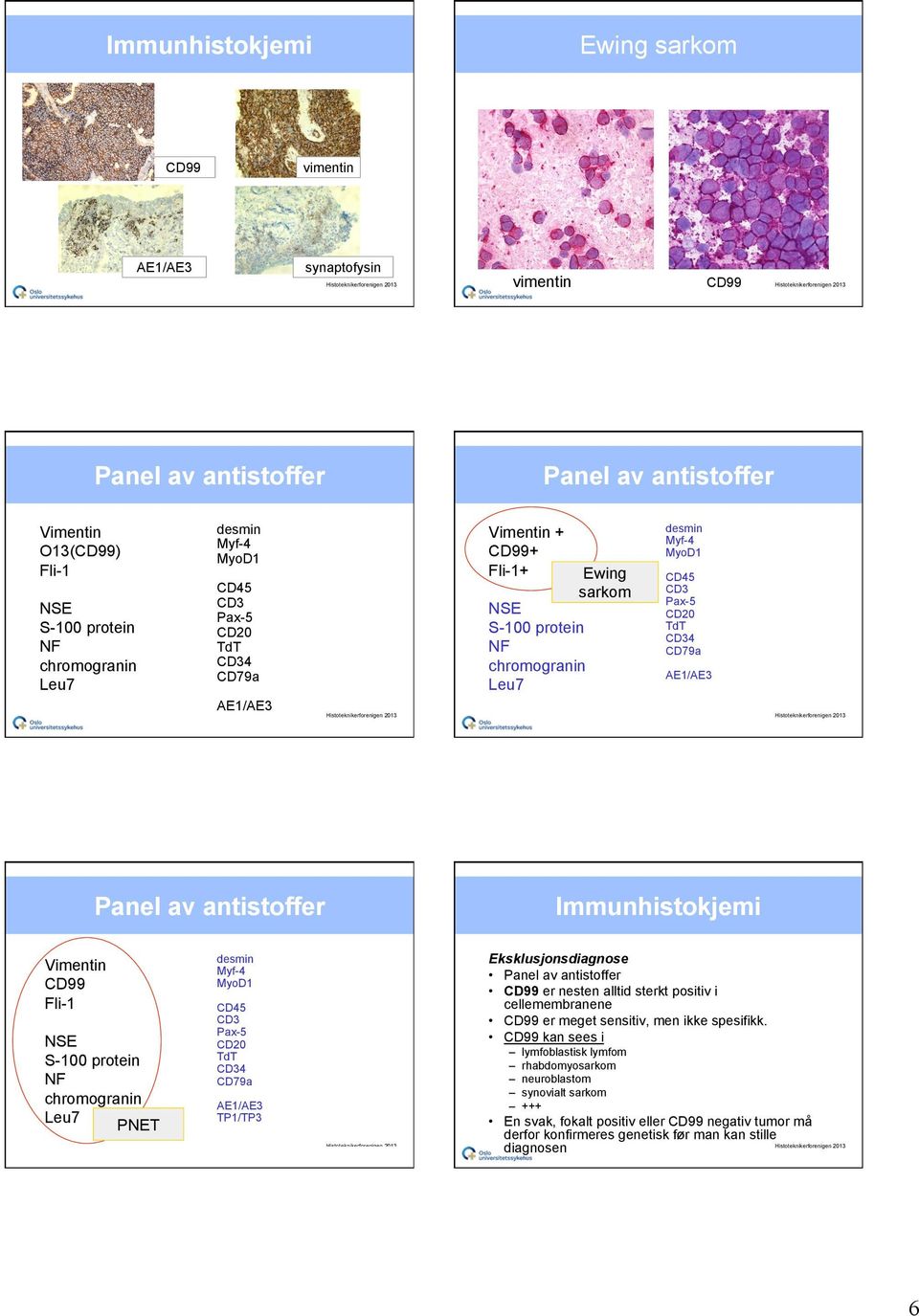 Immunhistokjemi Vimentin CD99 Fli-1 NSE S-100 protein NF chromogranin Leu7 PNET desmin Myf-4 MyoD1 CD45 CD3 Pax-5 CD20 TdT CD34 CD79a AE1/AE3 TP1/TP3 Eksklusjonsdiagnose Panel av antistoffer CD99 er