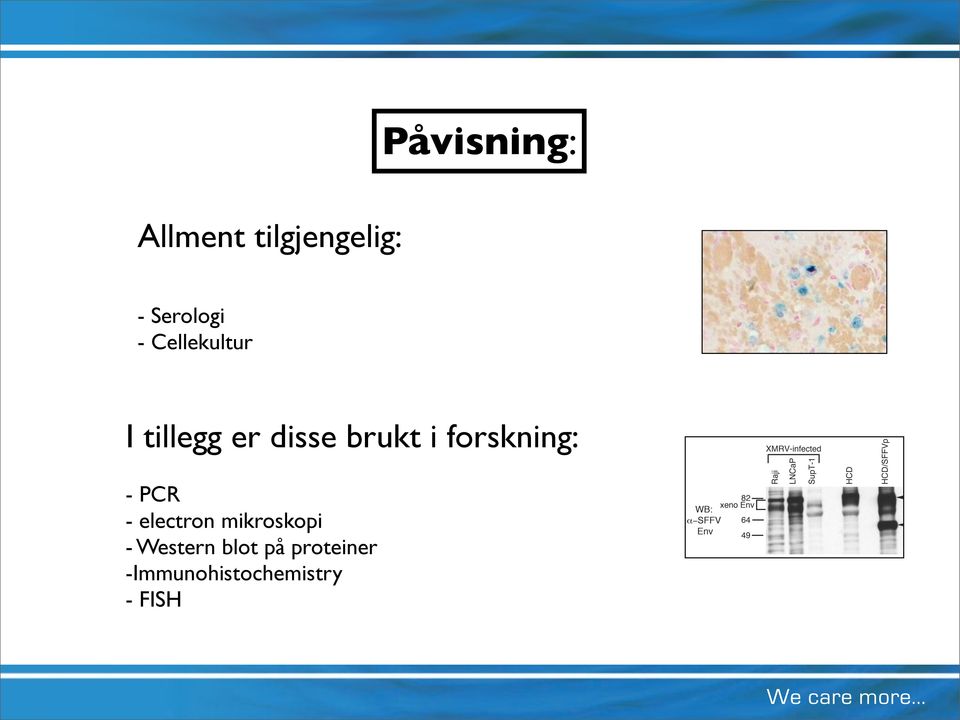 forskning: - PCR - electron mikroskopi -