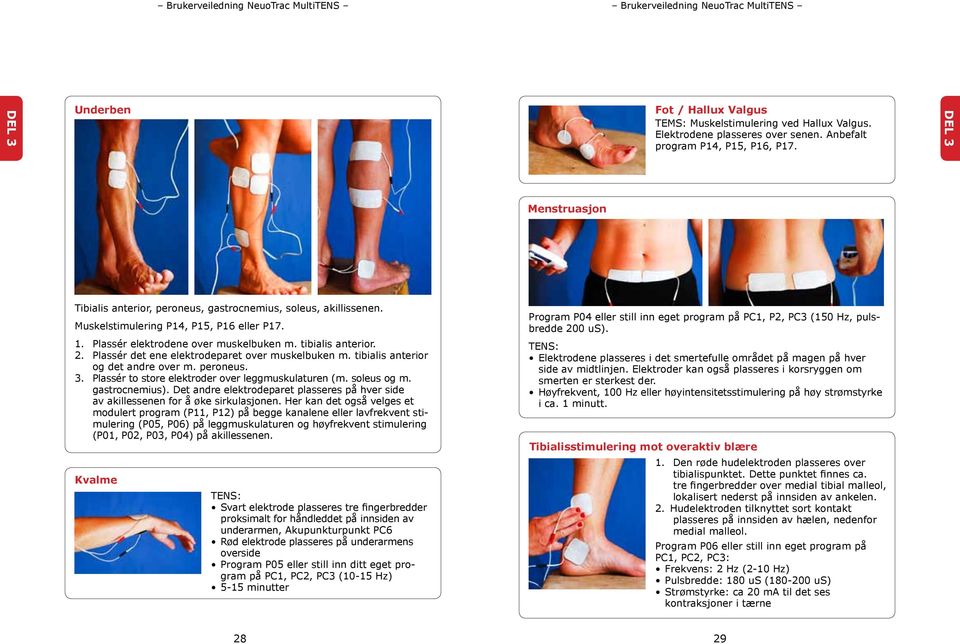 Plassér det ene elektrodeparet over muskelbuken m. tibialis anterior og det andre over m. peroneus. 3. Plassér to store elektroder over leggmuskulaturen (m. soleus og m. gastro cnemius).