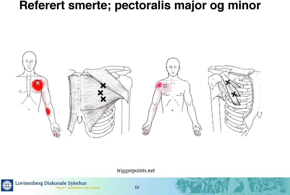 pectoralis