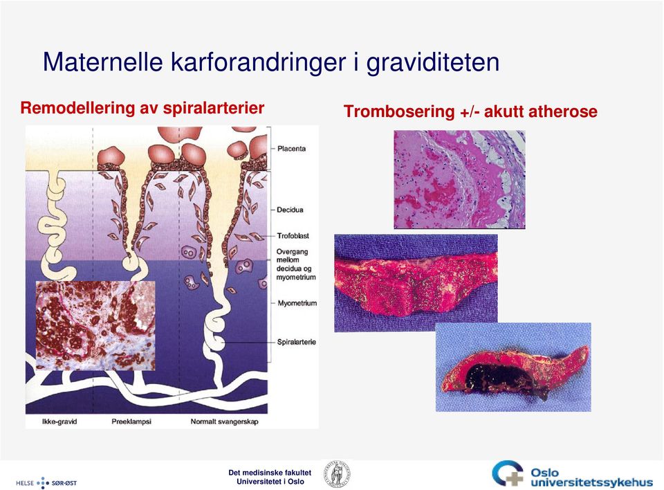 Remodellering av