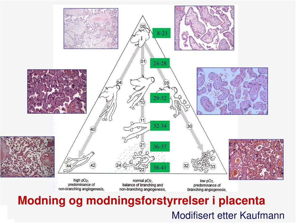 modningsforstyrrelser i