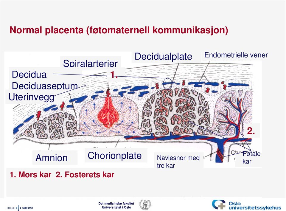 Deciduaseptum Uterinvegg Decidualplate Endometrielle