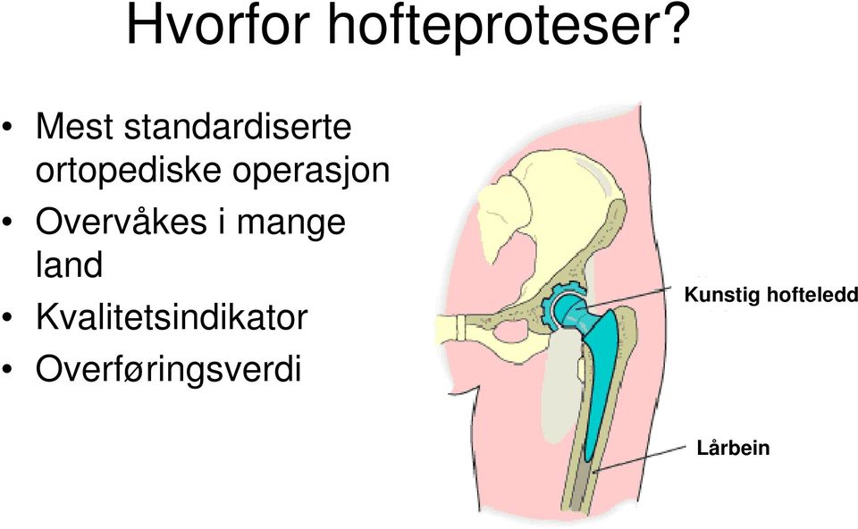 operasjon Overvåkes i mange land