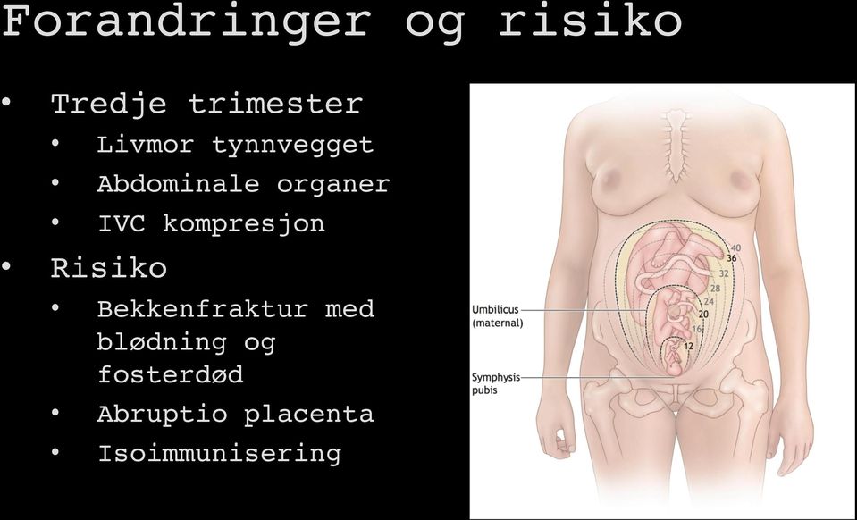 IVC kompresjon! Risiko!