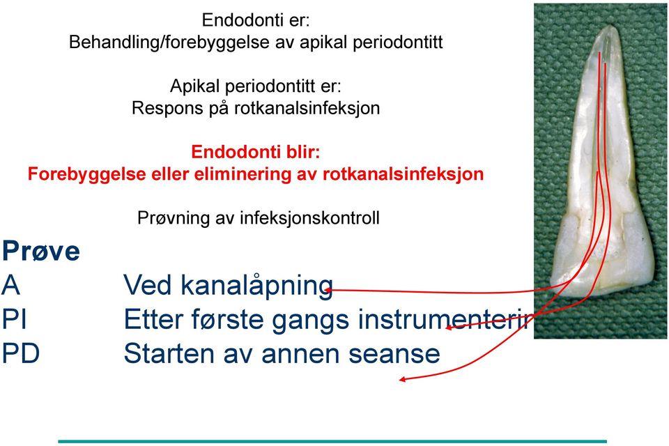 eller eliminering av rotkanalsinfeksjon Prøve A PI PD Prøvning av