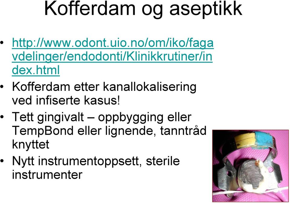 html Kofferdam etter kanallokalisering ved infiserte kasus!