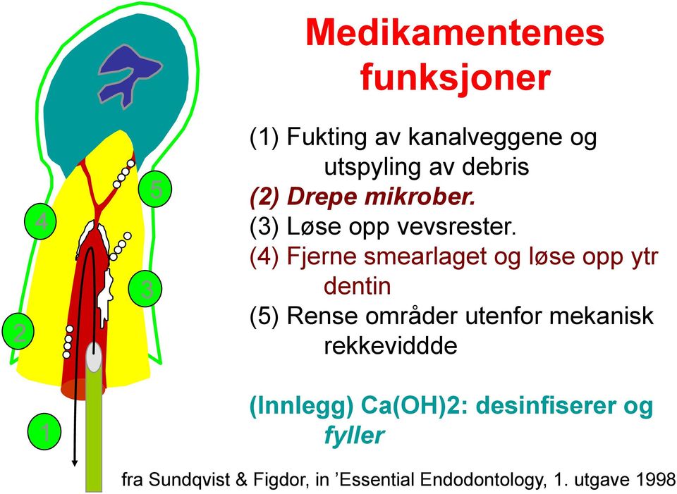 (4) Fjerne smearlaget og løse opp ytr dentin (5) Rense områder utenfor mekanisk