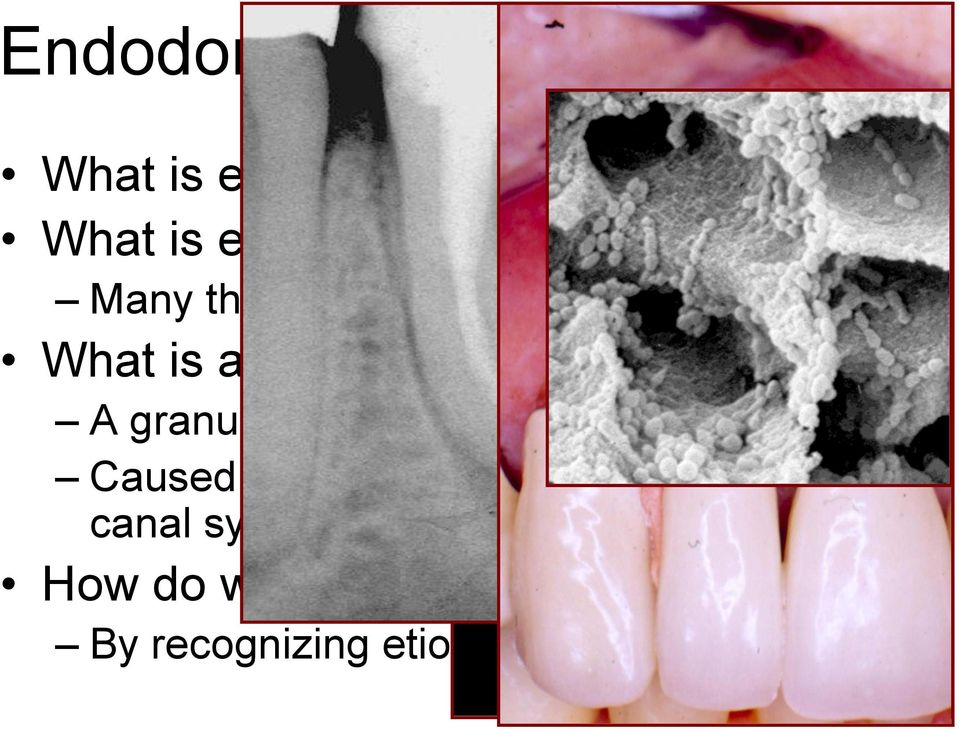 Many things, but one common factor: a lesion What is a lesion?