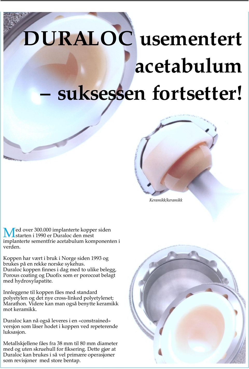 Duraloc koppen finnes i dag med to ulike belegg, Porous coating og Duofix som er porocoat belagt med hydroxylapatite.