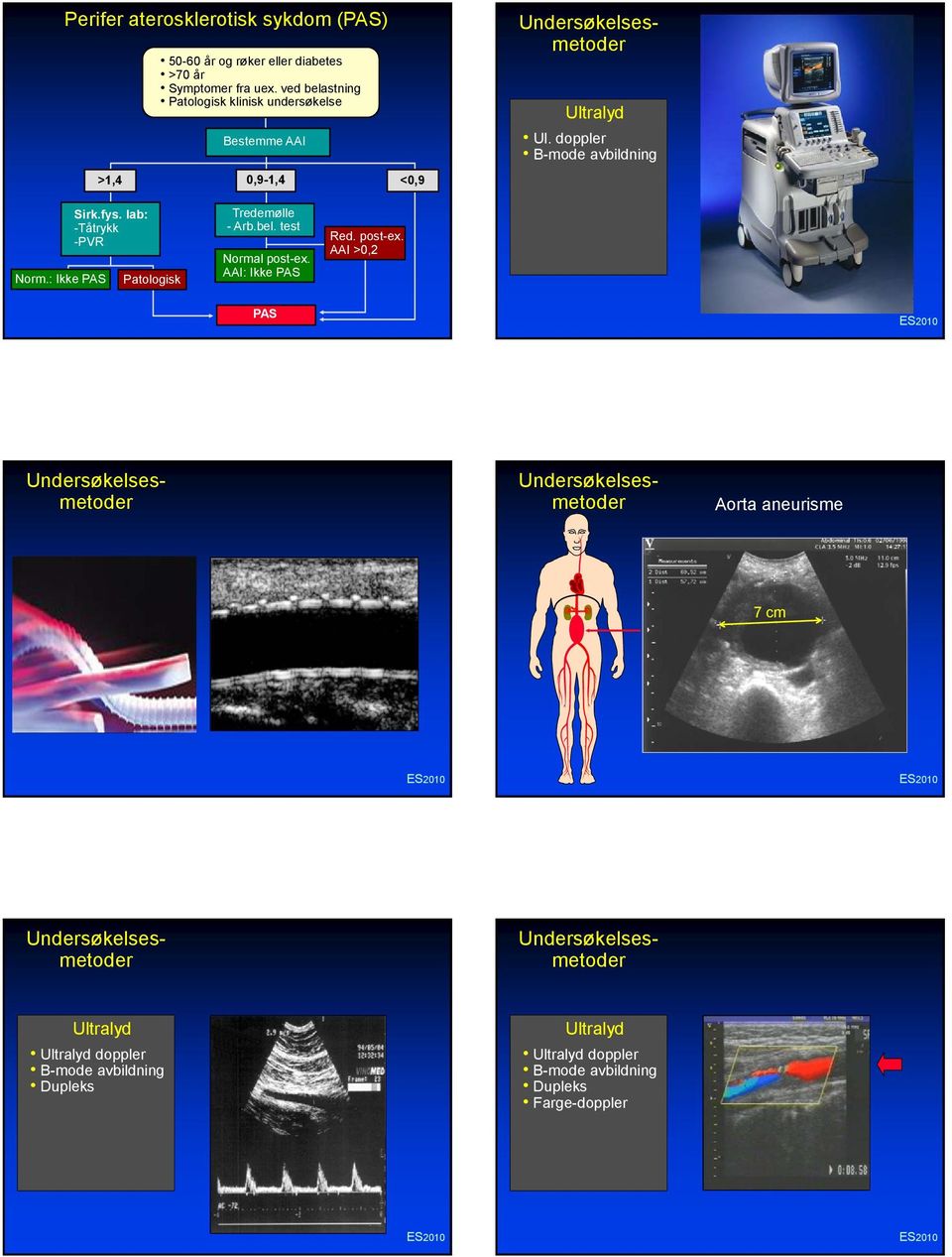 lab: -Tåtrykk -PVR Patologisk Tredemølle - Arb.bel. test post-ex. AAI: Ikke PAS Red. post-ex. AAI >,2 PAS Aorta aneurisme Ultralyd Ul.