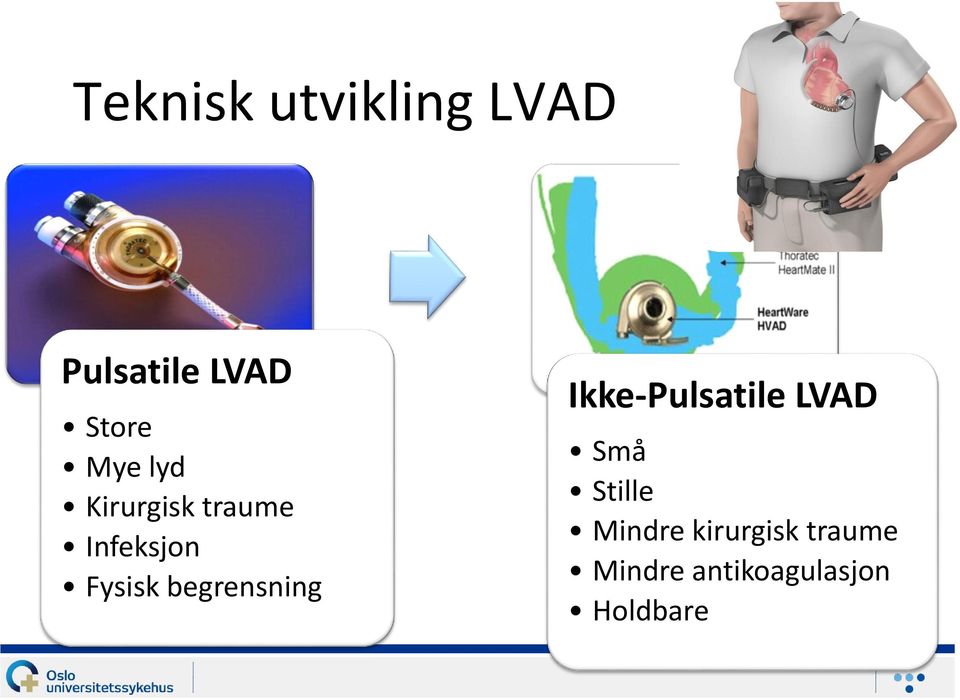 begrensning Ikke-Pulsatile LVAD Små Stille