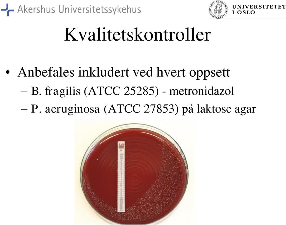 fragilis (ATCC 25285) -