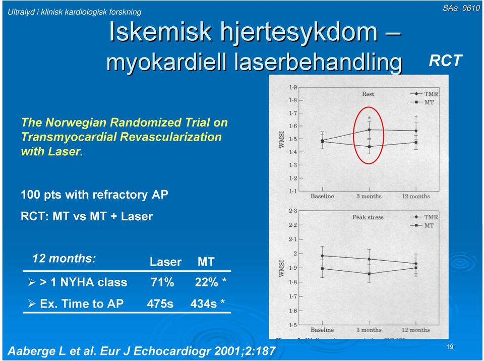 100 pts with refractory AP RCT: MT vs MT + Laser 12 months: Laser MT > 1