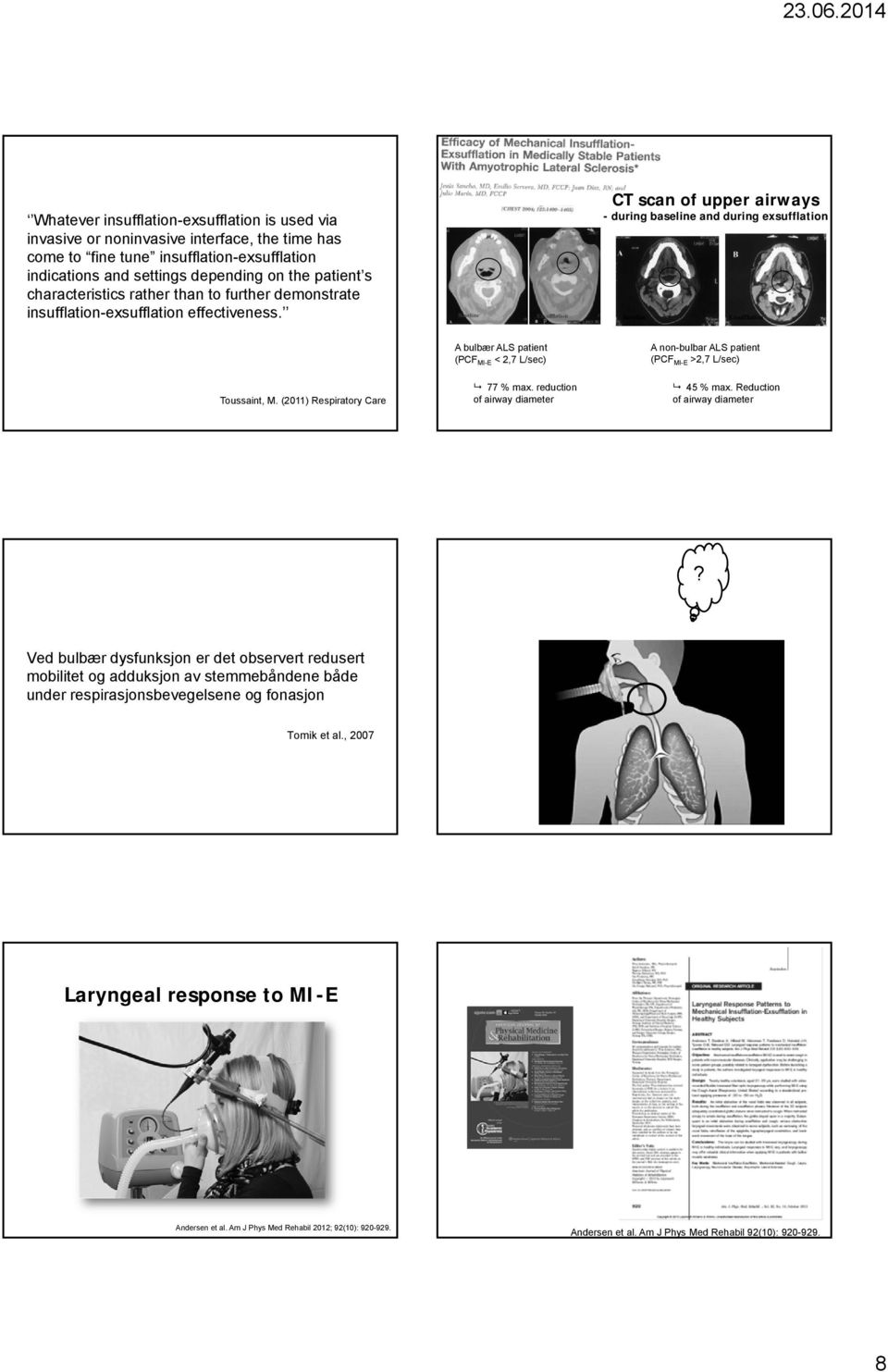 (2011) Respiratory Care A bulbær ALS patient (PCF MI-E < 2,7 L/sec) 77 % max. reduction of airway diameter A non-bulbar ALS patient (PCF MI-E >2,7 L/sec) 45 % max. Reduction of airway diameter?