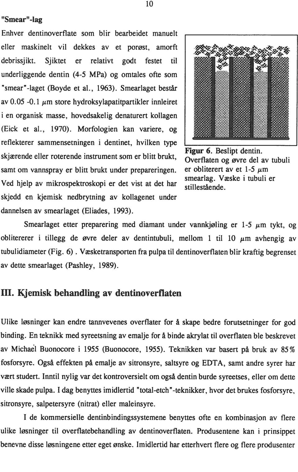 I dag benyttes imidlertid "total-etch "-teknikker, hvor det brukes fosforsyre, sitronsyre, salpetersyre (nitrat) eller maleinsyre.