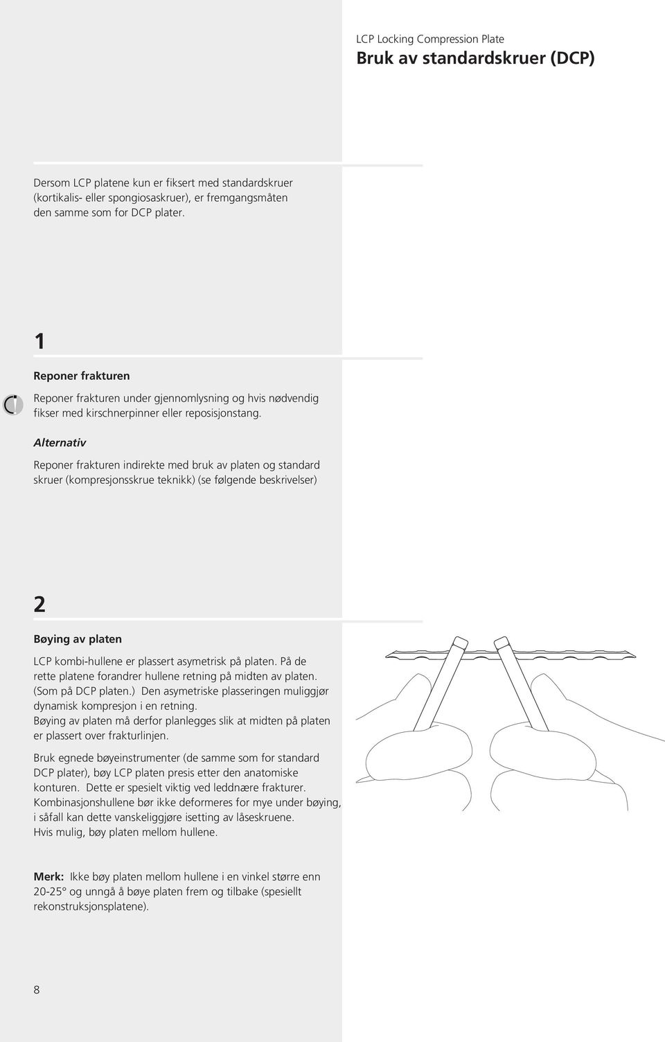 Alternativ Reponer frakturen indirekte med bruk av platen og standard skruer (kompresjonsskrue teknikk) (se følgende beskrivelser) 2 Bøying av platen LCP kombi-hullene er plassert asymetrisk på