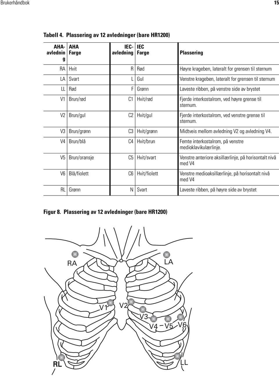 lateralt for grensen til sternum LL Rød F Grønn Laveste ribben, på venstre side av brystet V1 Brun/rød C1 Hvit/rød Fjerde interkostalrom, ved høyre grense til sternum.