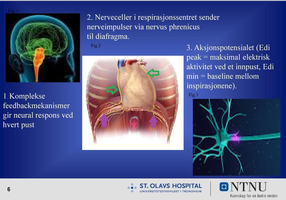 til diafragma. Fig.2 3.