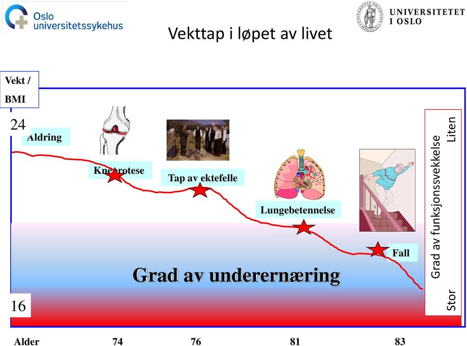 Aldring Kneprotese Tap av ektefelle