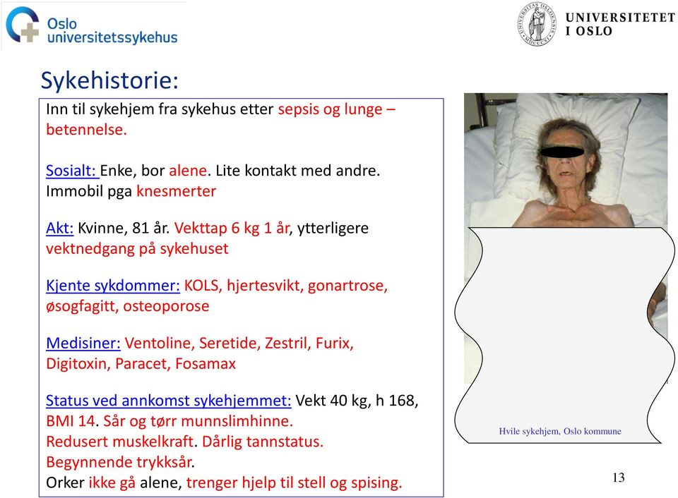 Vekttap 6 kg 1 år, ytterligere vektnedgang på sykehuset Kjente sykdommer: KOLS, hjertesvikt, gonartrose, øsogfagitt, osteoporose Medisiner: Ventoline,