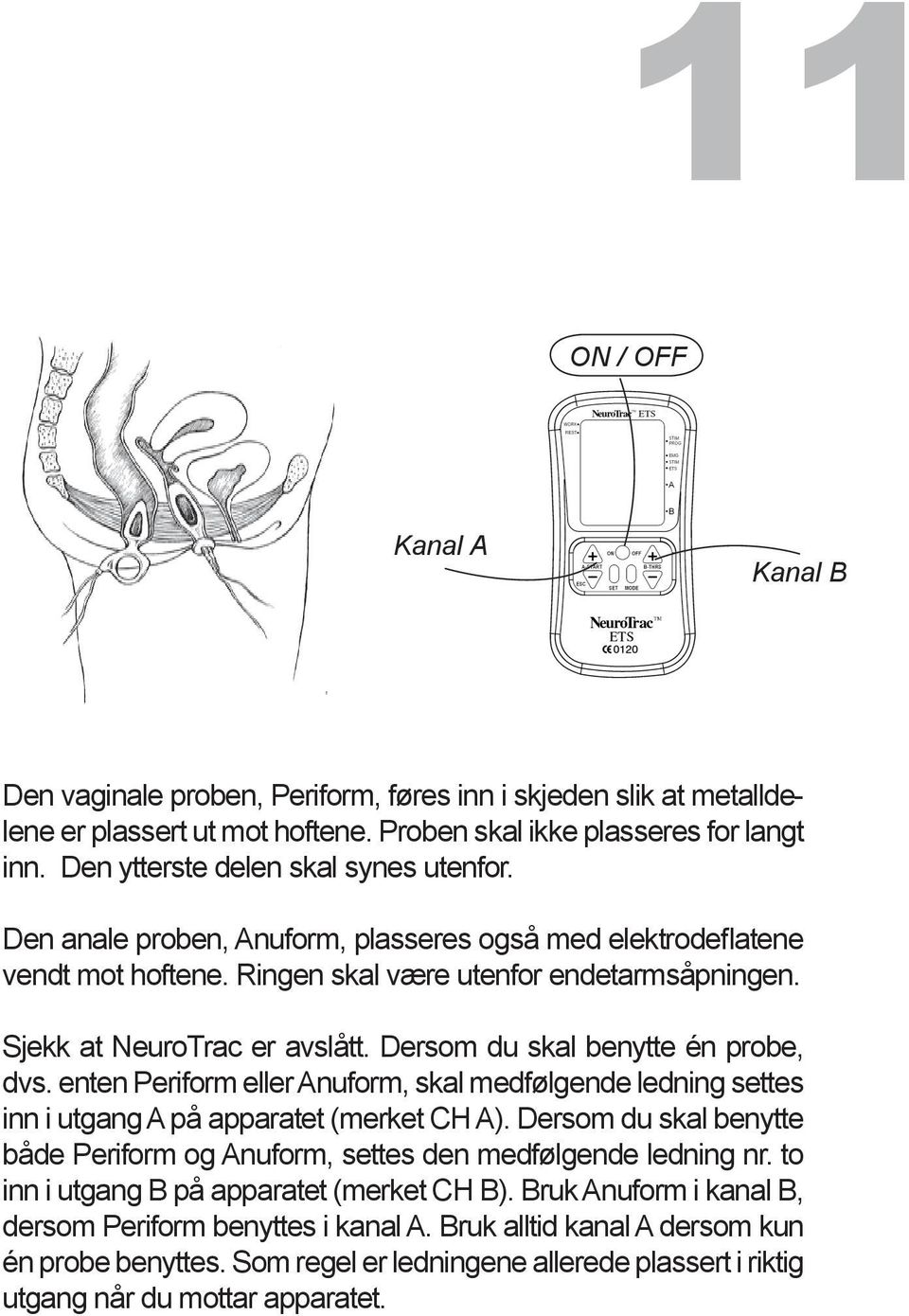 Dersom du skal benytte én probe, dvs. enten Periform eller Anuform, skal medfølgende ledning settes inn i utgang A på apparatet (merket CH A).