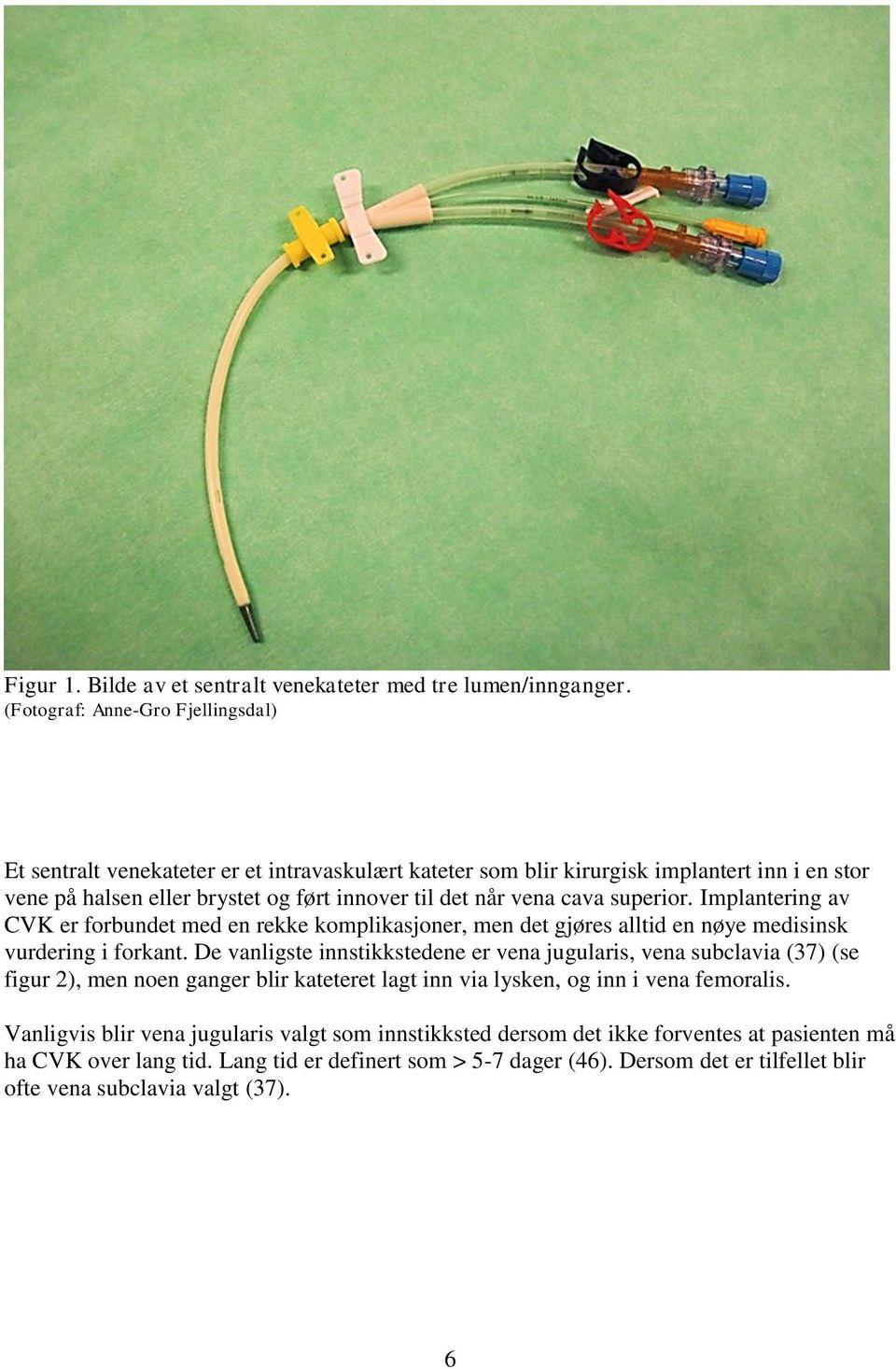 cava superior. Implantering av CVK er forbundet med en rekke komplikasjoner, men det gjøres alltid en nøye medisinsk vurdering i forkant.