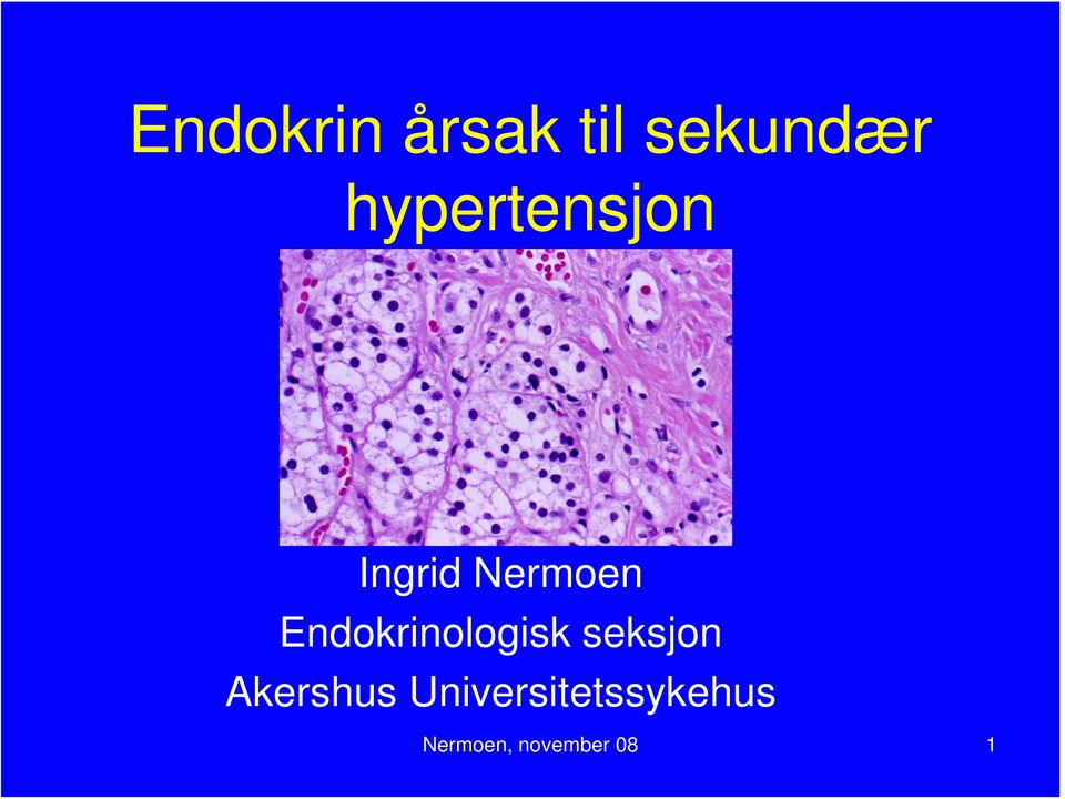 Endokrinologisk seksjon Akershus