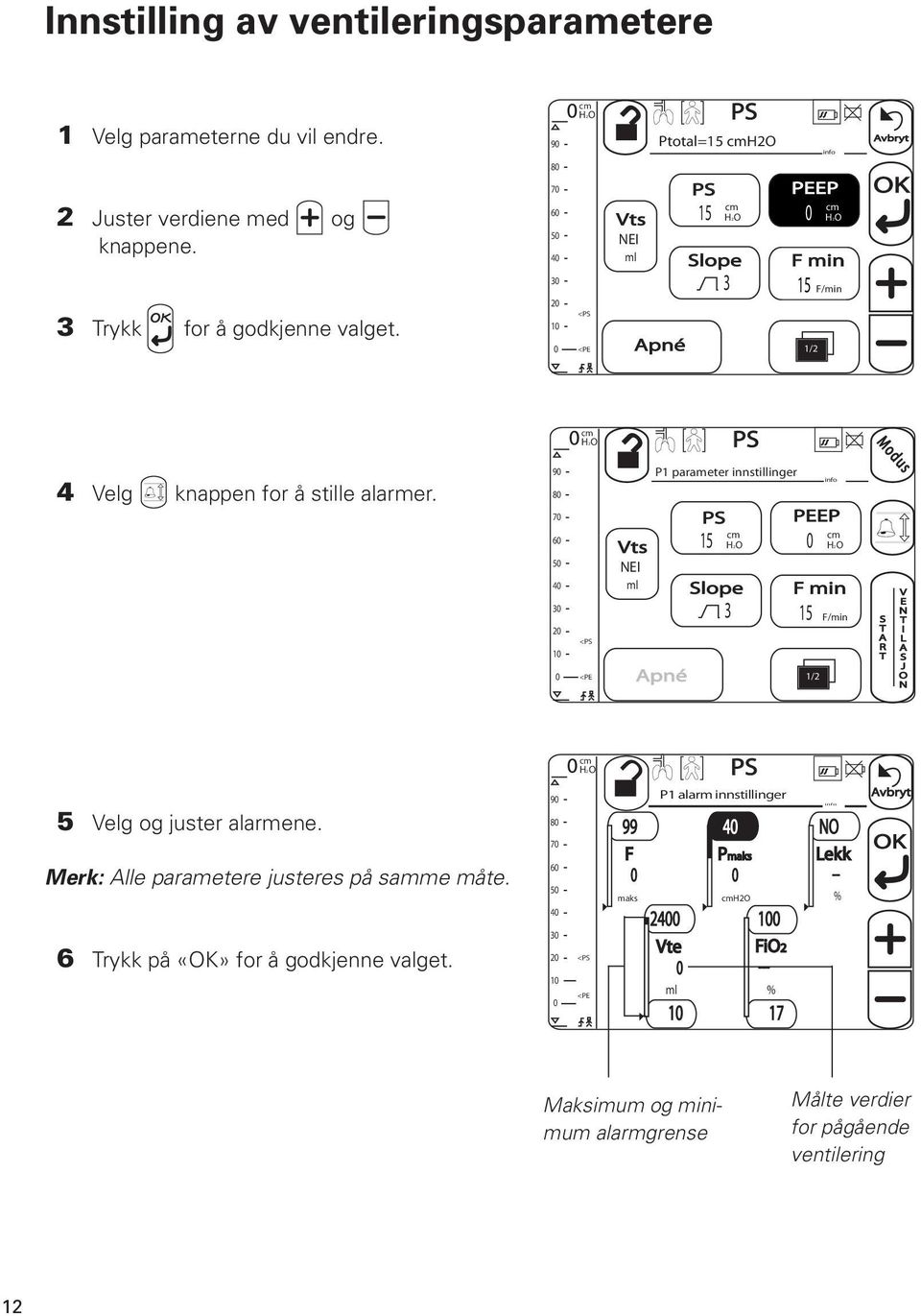 90 80 70 60 50 40 30 20 10 0 < <PE Vts NEI ml P1 parameter innstillinger Apné 15 Slope 1/2 info PEEP H2O 0 H2O F min 3 15 F/min S T A R T V E N T I L A S J O N 5 Velg og juster alarmene.