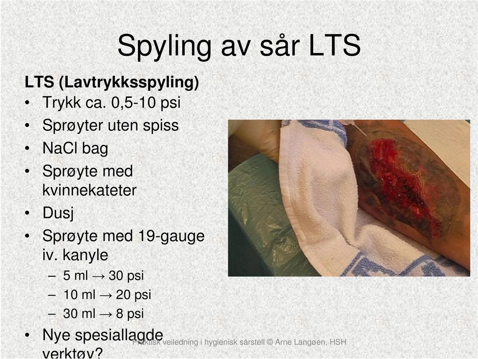 kvinnekateter Dusj Sprøyte med 19-gauge iv.