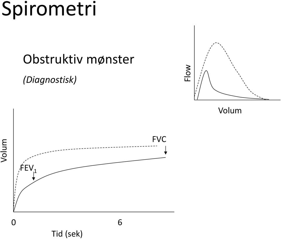 Obstruktiv mønster