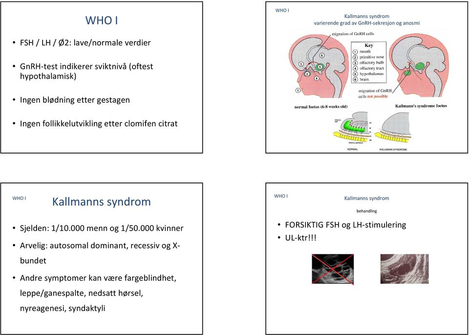 syndrom WHO I Kallmanns syndrom behandling Sjelden: 1/10.000 menn og 1/50.