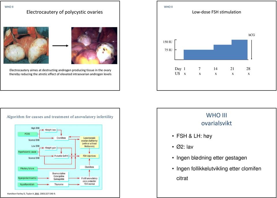 7 14 21 28 US x x x x x Algorithm for causes and treatment of anovulatory infertility I ovarialsvikt FSH & LH: høy Ø2: