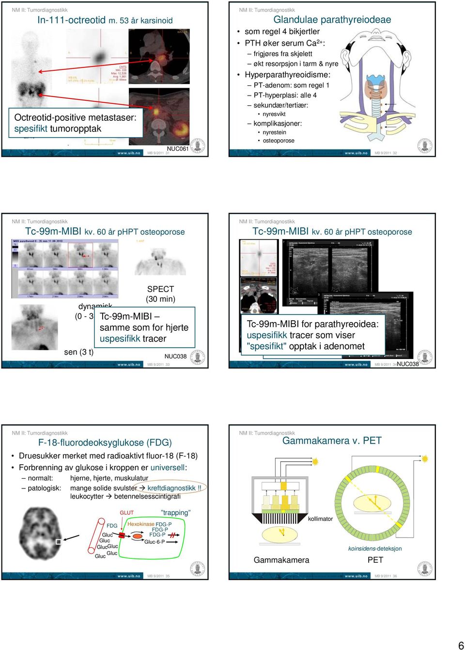 & nyre Hyperparathyreoidisme: PT-adenom: som regel 1 PT-hyperplasi: alle 4 sekundær/tertiær: nyresvikt komplikasjoner: nyrestein osteoporose 32 Tc-99m-MIBI kv. 60 år phpt osteoporose Tc-99m-MIBI kv.