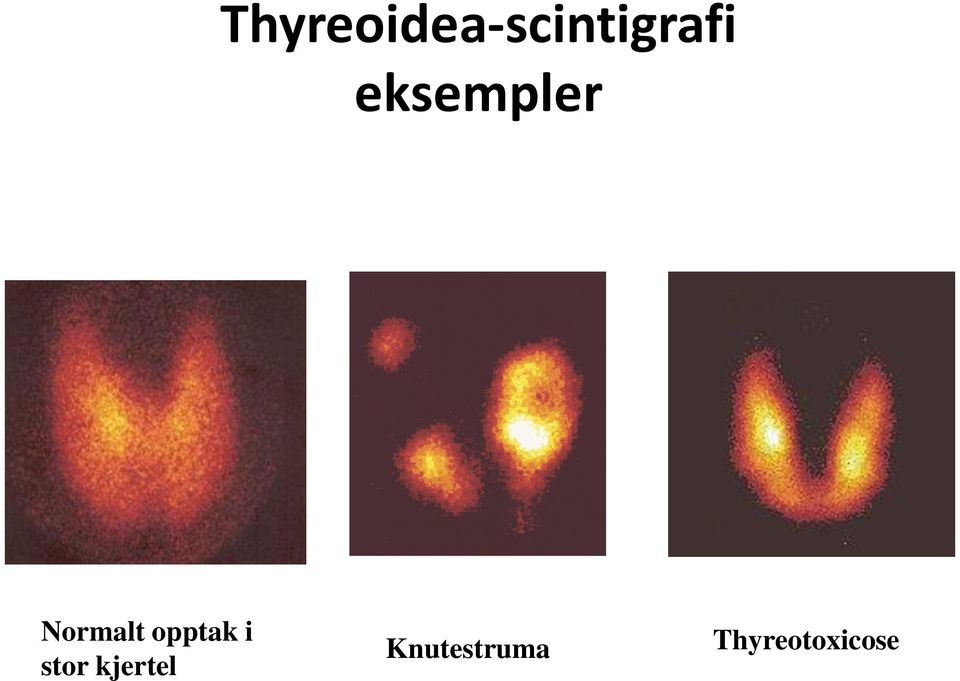 opptak i stor kjertel