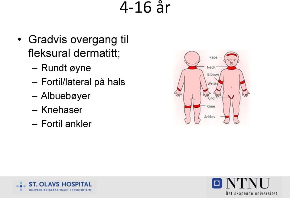 øyne Fortil/lateral på hals